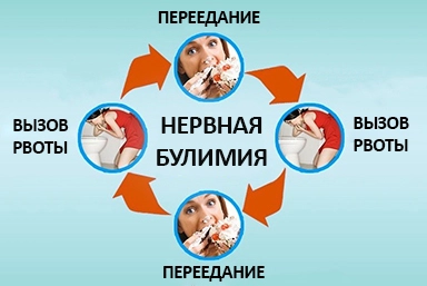 Лечение булимии в Иволгинске